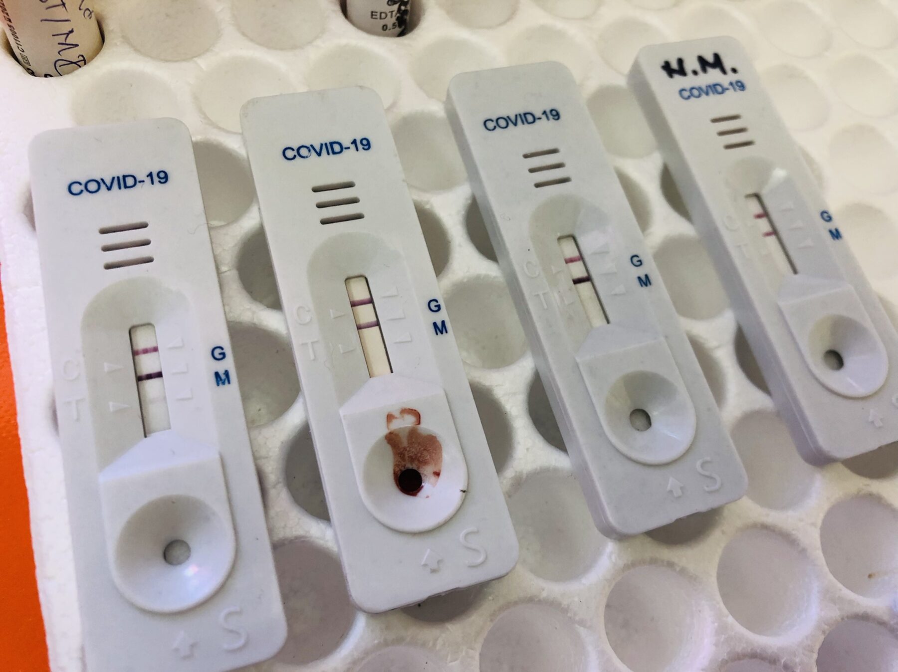 COVID19, antigen test, foto: Knjaževačke novine, sva prava zadržana